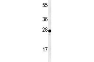 Western blot analysis of AANAT antibody and human Y79 lysate. (AANAT antibody  (AA 27-54))