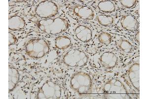 Immunoperoxidase of monoclonal antibody to MTSS1 on formalin-fixed paraffin-embedded human colon. (MTSS1 antibody  (AA 346-445))