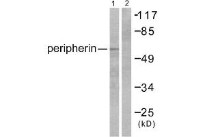 Western blot analysis of extracts from HepG2 cells, using Peripherin antibody (ABIN5976490).