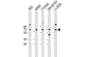 Western Blotting (WB) image for anti-delta Like Protein 3 (DLL3) (AA 545-573), (C-Term) antibody (ABIN656327)