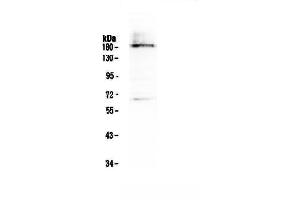 Western blot analysis of Dnmt1 using anti-Dnmt1 antibody . (DNMT1 antibody  (AA 22-126))