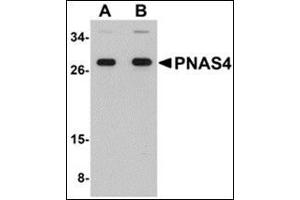 Western blot analysis of PNAS4 in EL4 cell lysate with this product at (A) 1 and (B) 2 μg/ml. (PPPDE1 antibody  (C-Term))