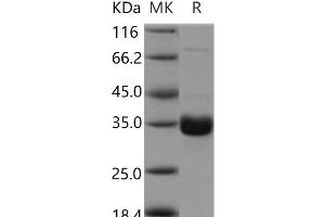 Western Blotting (WB) image for Collectin Sub-Family Member 11 (COLEC11) protein (His tag) (ABIN7195181) (COLEC11 Protein (His tag))