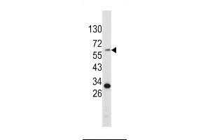 Western blot analysis of Tyrosinase antibody (C-term) (ABIN391520 and ABIN2841480) in HepG2 cell line lysates (35 μg/lane). (TYR antibody  (C-Term))