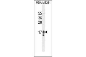 Western blot analysis of PIP / GCDFP15 Antibody (C-term) in MDA-MB231 cell line lysates (35ug/lane).
