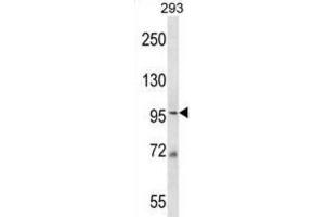Western Blotting (WB) image for anti-Minichromosome Maintenance Complex Component 6 (MCM6) antibody (ABIN2998200) (MCM6 antibody)