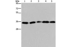 Western Blot analysis of Hela cell, Jurkat cell and Human placenta tissue, Human testis tissue and 231 cell using OCIAD1 Polyclonal Antibody at dilution of 1:200 (OCIAD1 antibody)