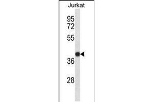 Western blot analysis in Jurkat cell line lysates (35ug/lane). (SET/TAF-I antibody  (N-Term))