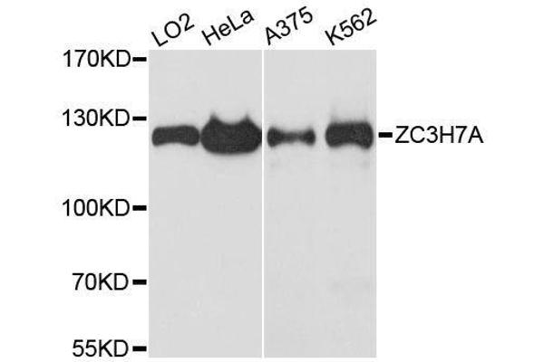 ZC3H7A Antikörper  (AA 1-220)