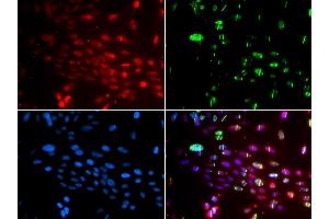 Immunofluorescence analysis of GFP-RNF168 transgenic U2OS cells using L3MBTL1 antibody (ABIN5974264). (L3MBTL1 antibody)