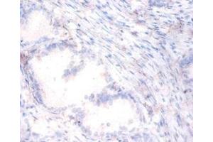 Immunohistochemistry of paraffin-embedded human prostate tissue using ABIN7169381 at dilution of 1:100 (PON1 antibody  (AA 2-355))