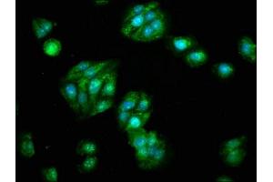 Immunofluorescence (IF) image for anti-Aldehyde Dehydrogenase 5 Family, Member A1 (ALDH5A1) (AA 48-535) antibody (ABIN7170921)