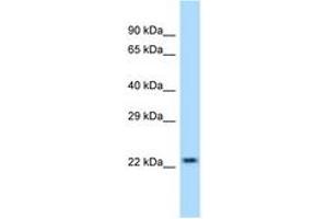 Image no. 1 for anti-Sorcin (SRI) (AA 96-145) antibody (ABIN6747971) (SRI antibody  (AA 96-145))