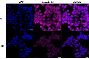 anti-Annexin A4 (ANXA4) antibody