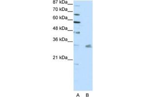 Western Blotting (WB) image for anti-Pituitary Homeobox 3 (PITX3) antibody (ABIN2461738) (PITX3 antibody)