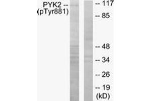 Western blot analysis of extracts from mouse brain, using PYK2 (Phospho-Tyr881) Antibody. (PTK2B antibody  (pTyr881))
