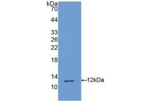 Detection of Recombinant OSM, Mouse using Polyclonal Antibody to Oncostatin M (OSM) (Oncostatin M antibody  (AA 25-115))