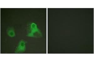 Immunofluorescence analysis of HeLa cells, using ADD1 (Phospho-Ser726) Antibody. (alpha Adducin antibody  (pSer726))