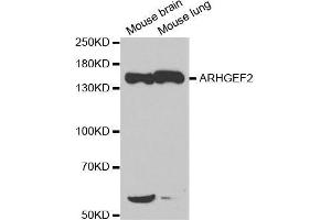 Western blot analysis of extracts of various cell lines, using ARHGEF2 antibody. (ARHGEF2 antibody)
