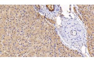 Immunohistochemistry (IHC) image for anti-Interleukin 6 Signal Transducer (Gp130, Oncostatin M Receptor) (IL6ST) (AA 392-566) antibody (ABIN7430552)