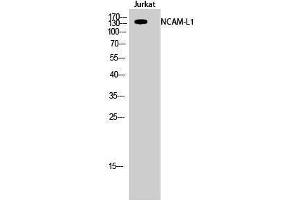 Western Blotting (WB) image for anti-L1 Cell Adhesion Molecule (L1CAM) (Ser727) antibody (ABIN3185776) (L1CAM antibody  (Ser727))