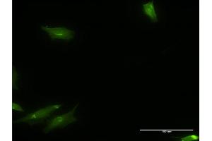 Immunofluorescence of monoclonal antibody to CAMKK1 on HeLa cell. (CAMKK1 antibody  (AA 2-100))
