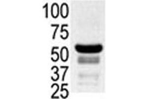 Western blot testing of ovary lysate with PAK2 antibody. (PAK2 antibody  (AA 192-222))