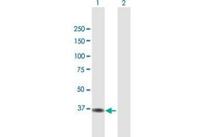 Western Blot analysis of ACAD8 expression in transfected 293T cell line by ACAD8 MaxPab polyclonal antibody. (Acad8 antibody  (AA 1-415))