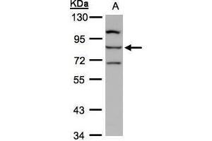 WB Image Sample(30 ug whole cell lysate) A:Hep G2 , 7. (ALOXE3 antibody)