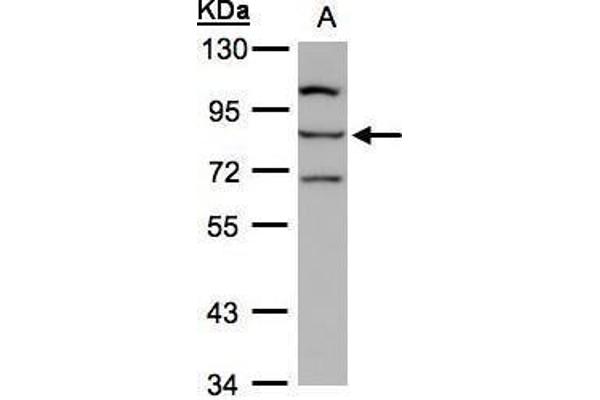 ALOXE3 anticorps