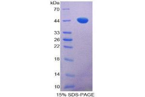 SDS-PAGE (SDS) image for tau Protein (AA 92-400) protein (His tag) (ABIN2125879)