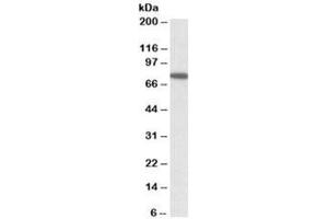 Western blot testing of HeLa lysate with SNX1 antibody at 1ug/ml. (Sorting Nexin 1 antibody)