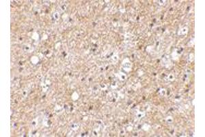 Immunohistochemical staining of human brain tissue using SP110 polyclonal antibody  at 2. (SP110 antibody  (C-Term))