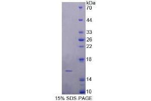 SDS-PAGE (SDS) image for Fatty Acid Binding Protein 4, Adipocyte (FABP4) (AA 2-132) protein (His tag) (ABIN1099056) (FABP4 Protein (AA 2-132) (His tag))