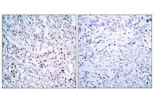 Immunohistochemistry (IHC) image for anti-Jun Proto-Oncogene (JUN) (pSer63) antibody (ABIN1847457) (C-JUN antibody  (pSer63))