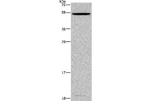 Western blot analysis of Mouse testis tissue, using CATSPER3 Polyclonal Antibody at dilution of 1:350 (CATSPER3 antibody)