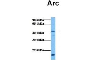 Host:  Rabbit  Target Name:  Arc  Sample Tissue:  Mouse Brain  Antibody Dilution:  1. (ARC (Middle Region) antibody)