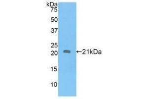 Detection of Recombinant APOD, Human using Polyclonal Antibody to Apolipoprotein D (APOD) (Apolipoprotein D antibody  (AA 21-189))