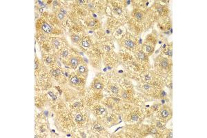 Immunohistochemistry of paraffin-embedded human liver injury using OGT antibody (ABIN4904611) at dilution of 1:100 (40x lens).