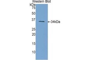 Detection of Recombinant PLXNB1, Human using Polyclonal Antibody to Plexin B1 (PLXNB1) (PLXNB1 antibody  (AA 1780-2042))
