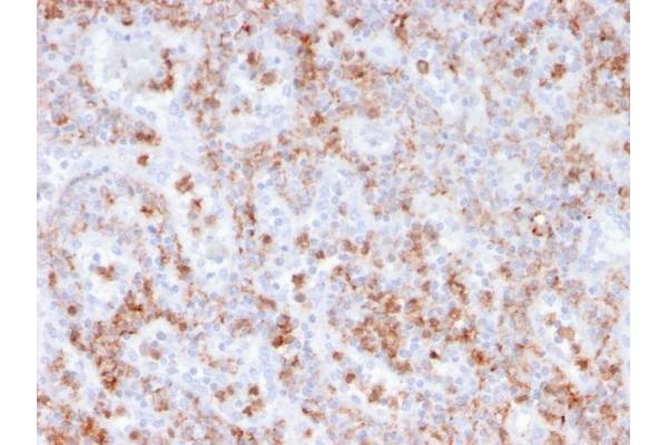 Recombinant S100A8/A9 Complex (Calprotectin) antibody