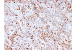 Formalin-fixed, paraffin-embedded human spleen stained with S100A9 Recombinant Mouse Monoclonal Antibody (rMAC3781). (Recombinant S100A8 antibody)