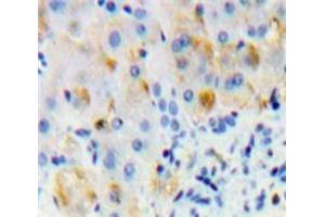 IHC-P analysis of Liver tissue, with DAB staining. (Oncostatin M Receptor antibody  (AA 503-749))