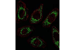 Fluorescent image of A549 cell stained with OAT Antibody (N-term) (ABIN652844 and ABIN2842548)/SA100310AG. (OAT antibody  (N-Term))