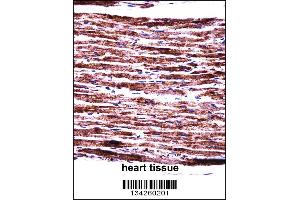 PERP Antibody immunohistochemistry analysis in formalin fixed and paraffin embedded human heart tissue followed by peroxidase conjugation of the secondary antibody and DAB staining. (PERP antibody  (C-Term))