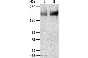 Western blot analysis of Human jejunoileum and ileum tissue, using TRPM6 Polyclonal Antibody at dilution of 1:200