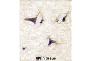 Formalin-fixed and paraffin-embedded human brain tissue reacted with DM2 Antibody (N-term) (ABIN391860 and ABIN2841691) , which was peroxidase-conjugated to the secondary antibody, followed by DAB staining. (DAAM2 antibody  (N-Term))