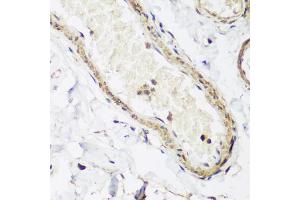 Immunohistochemistry of paraffin-embedded human colon using CAV3 antibody (ABIN5974782) at dilution of 1/200 (40x lens). (Caveolin 3 antibody)