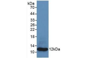 Western blot analysis of recombinant Human S100A8.