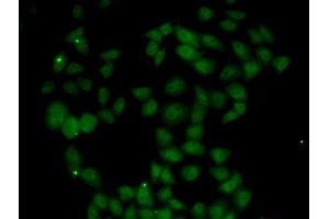 Immunofluorescence analysis of U2OS cells using FGF14 antibody.